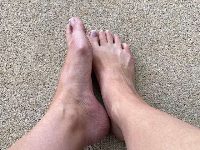 Why You Should Allow Massage on Your Feet